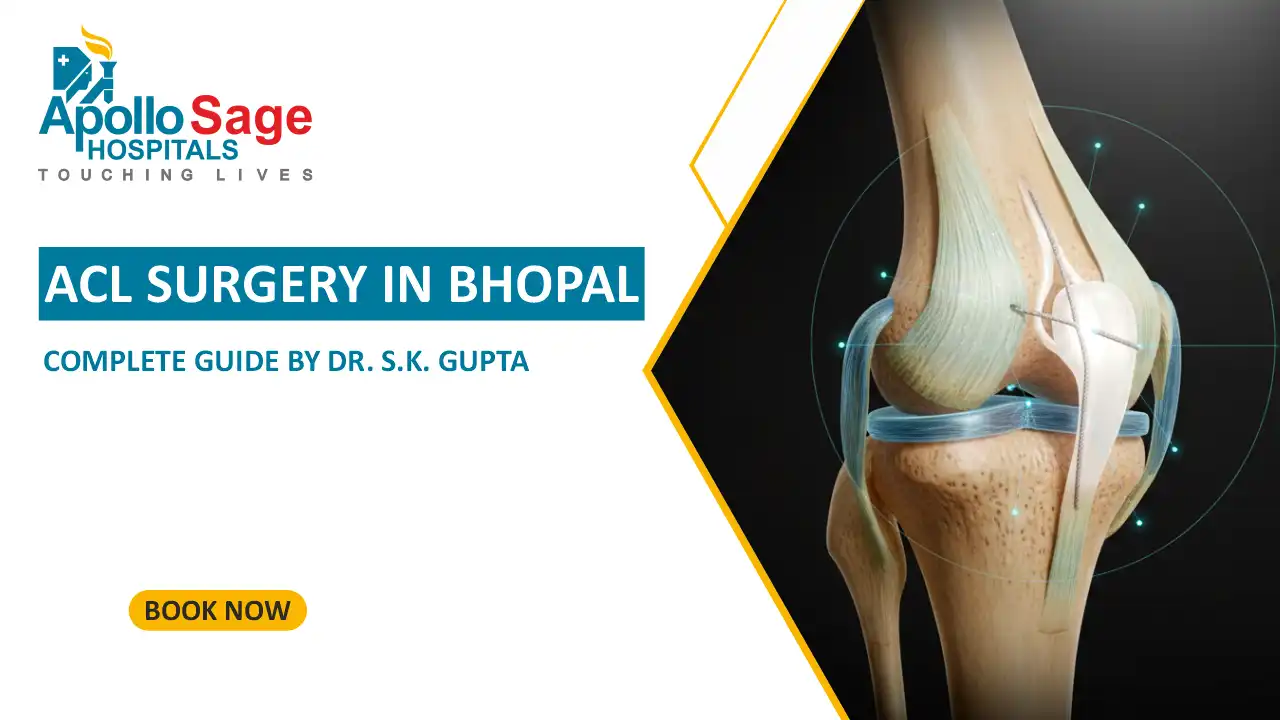 ACL Surgery in Bhopal: Complete Guide by Dr S. K. Gupta