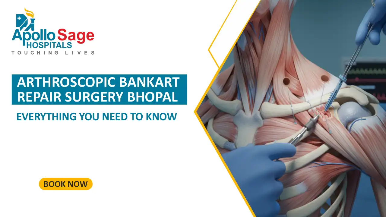 Arthroscopic Bankart Repair Surgery Bhopal : Everything You Need to Know