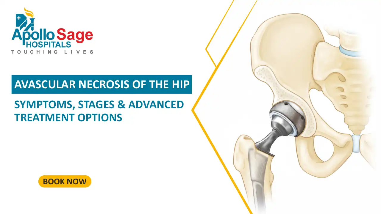 Avascular Necrosis of the Hip: Symptoms, Stages & Advanced Treatment Options
