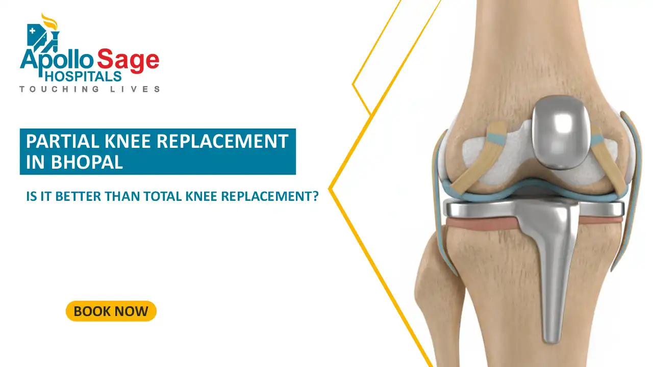 Partial Knee Replacement in Bhopal: Is It Better Than Total Knee Replacement?