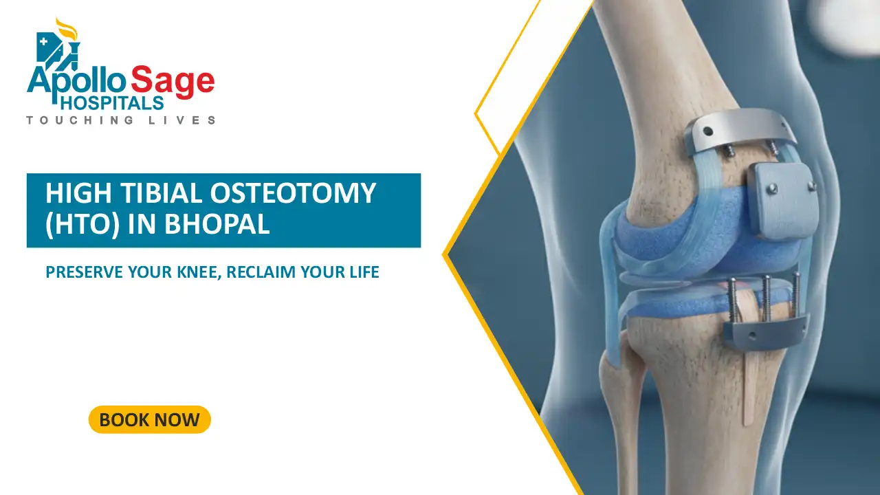High Tibial Osteotomy (HTO) in Bhopal: Preserve Your Knee, Reclaim Your Life