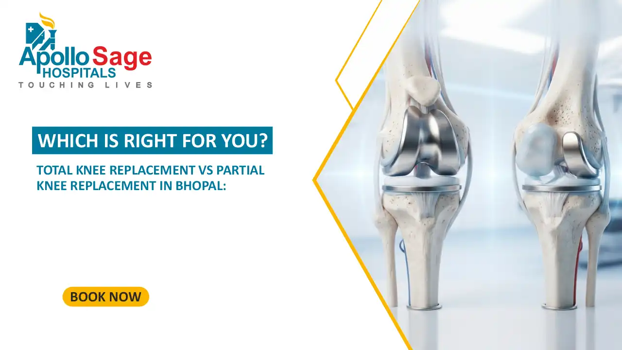 Total Knee Replacement vs Partial Knee Replacement in Bhopal: Which Is Right for You?