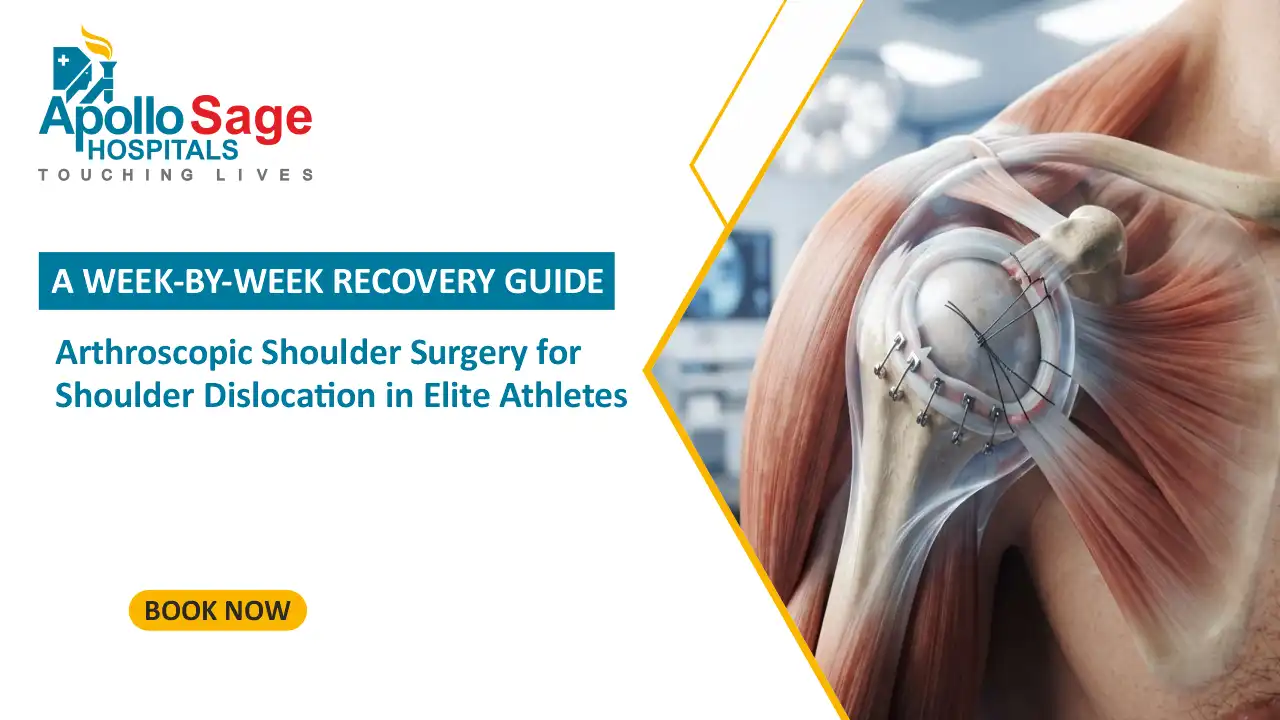 Arthroscopic Shoulder Surgery for Shoulder Dislocation in Elite Athletes: A Week-by-Week Recovery Guide