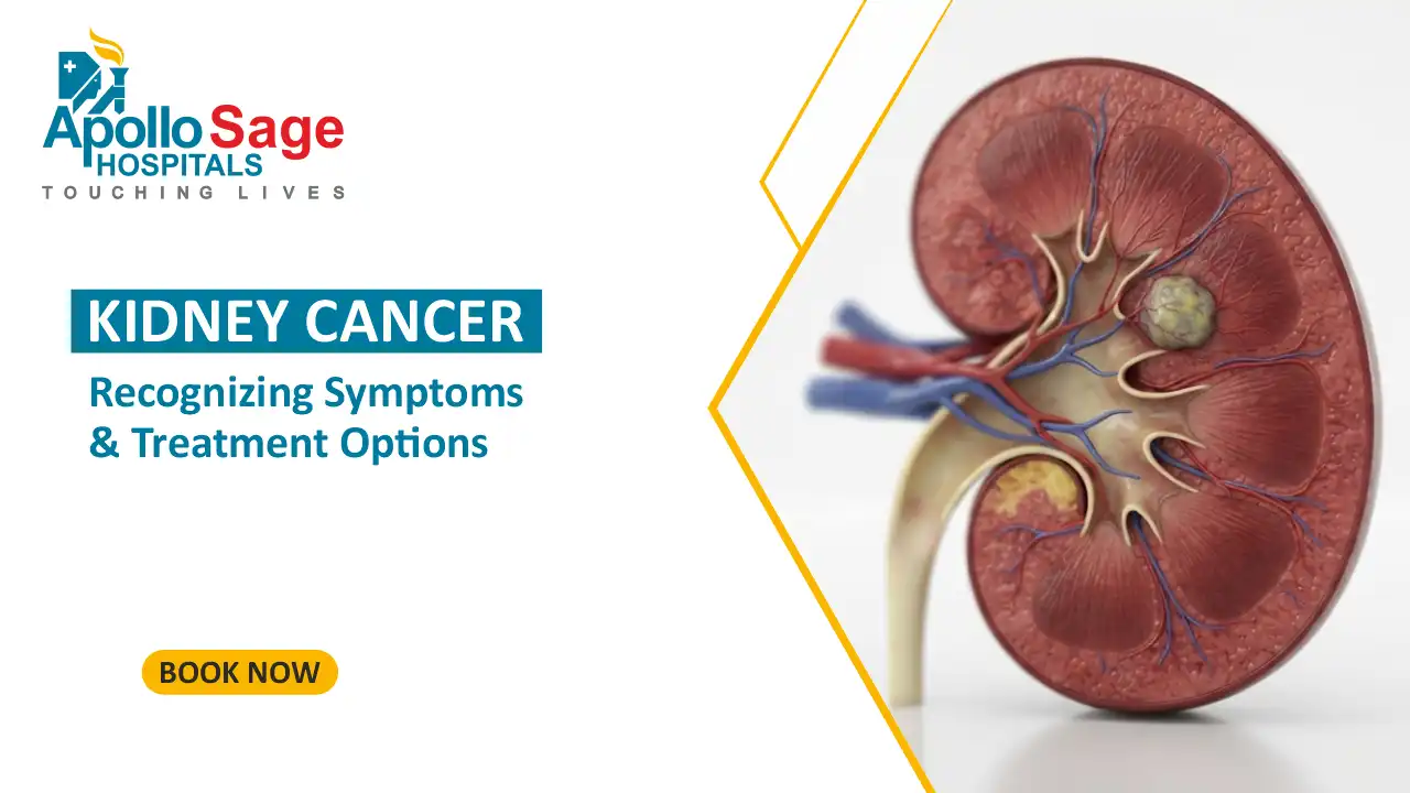 Kidney Cancer: Recognizing Symptoms and Treatment Options