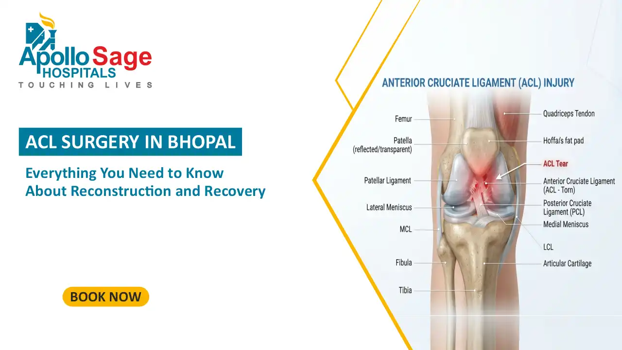 ACL Surgery in Bhopal - Everything You Need to Know About Reconstruction and Recovery
