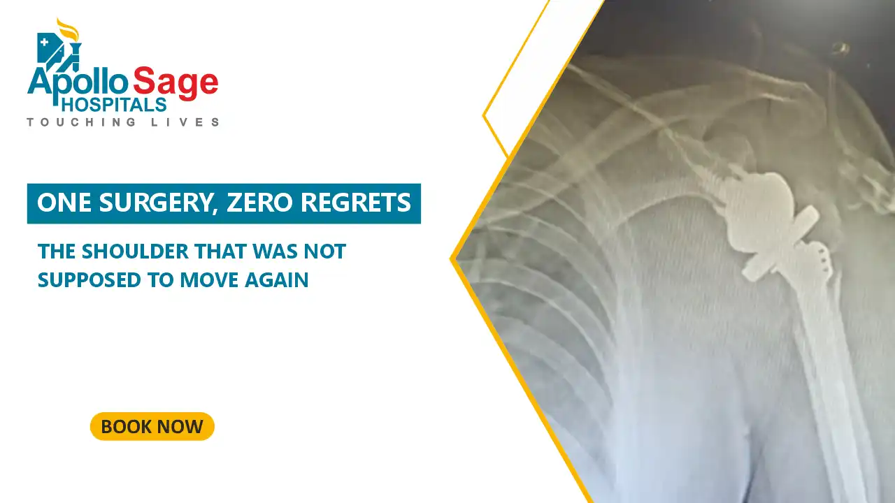 When Fixing the Fracture Wasn't Enough: The Shoulder That Learned to Move Again