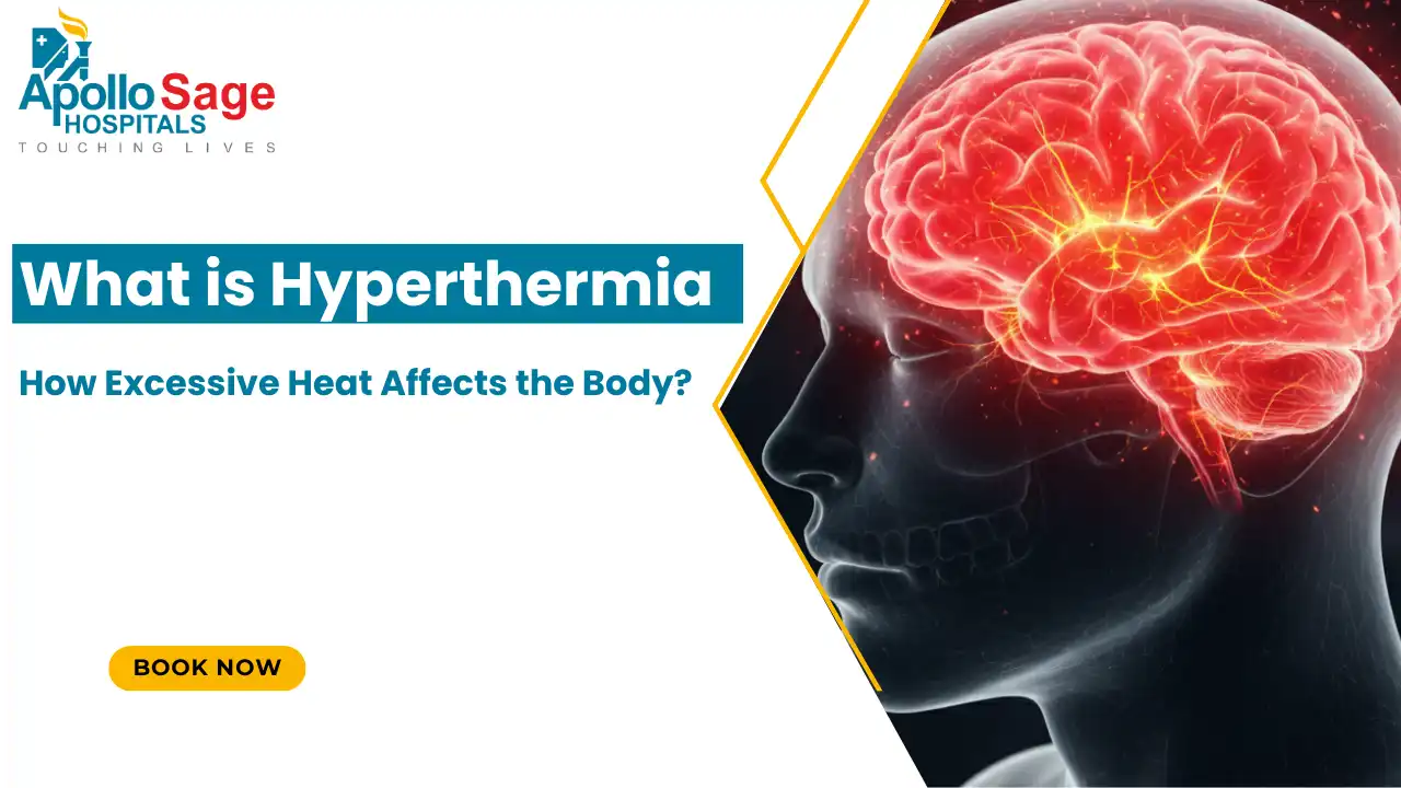 What is Hyperthermia: How Excessive Heat Affects the Body?